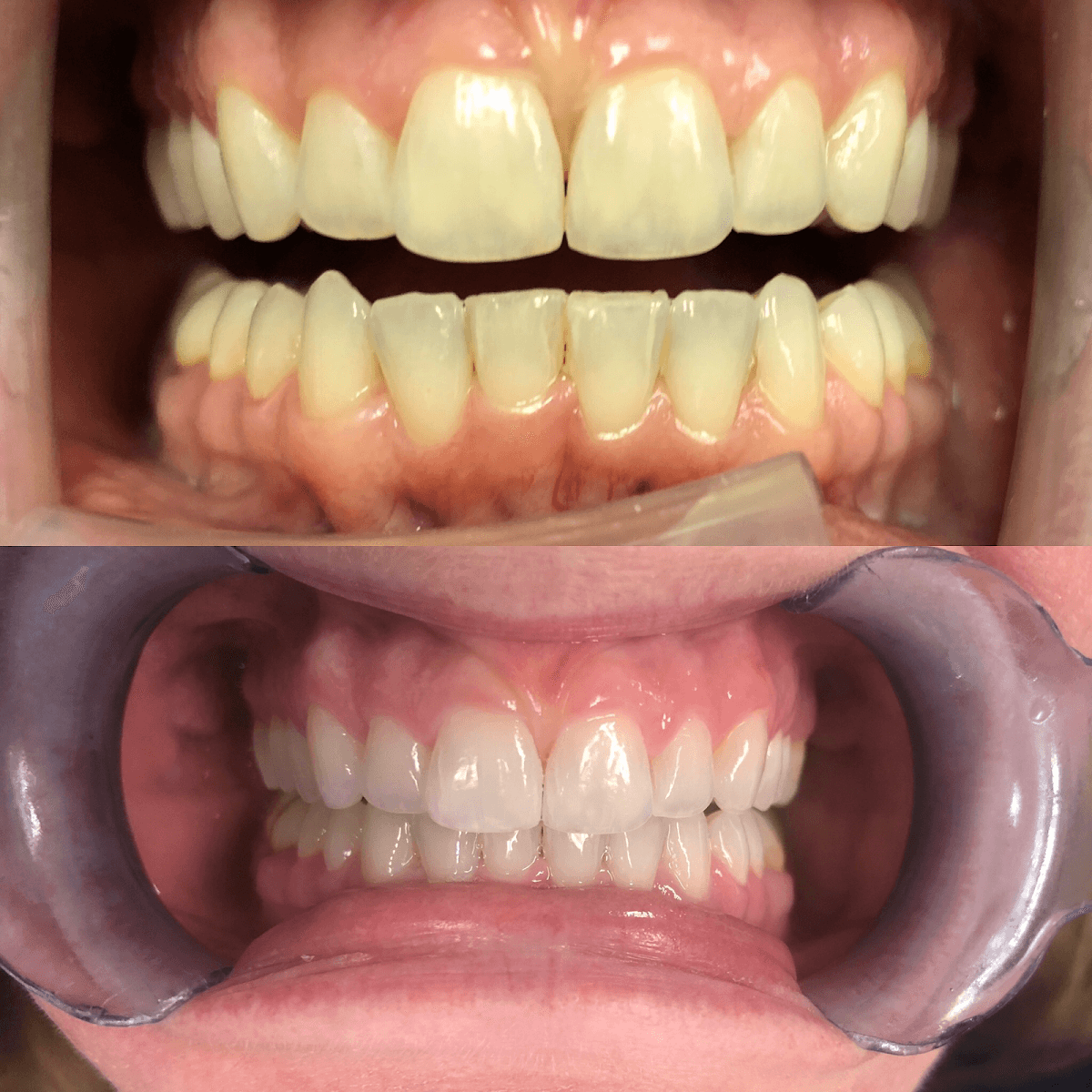 Athens Dental Associates photo 5