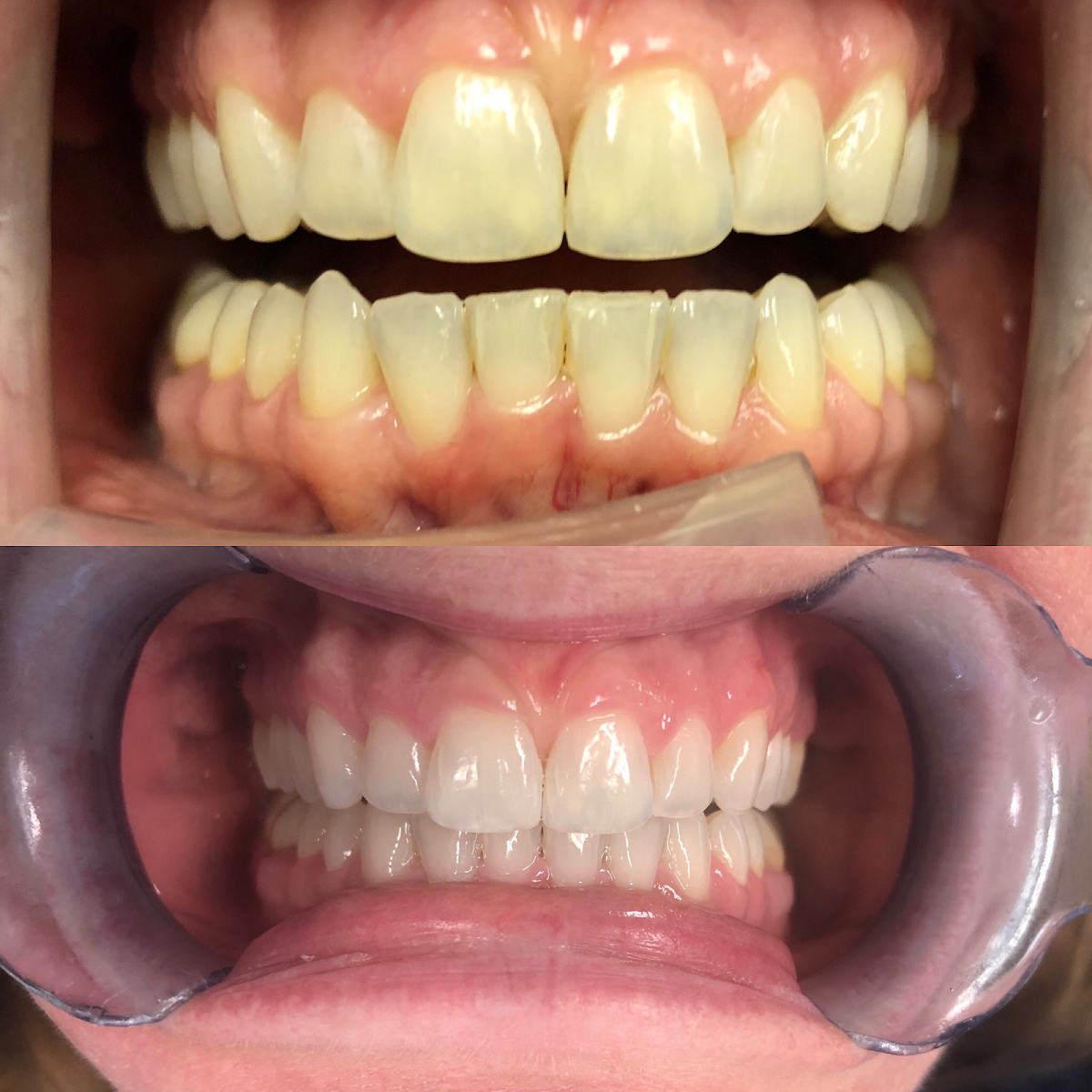 Athens Dental Associates photo 5